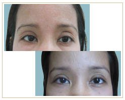 Slider image (8) Roura DermSurgery